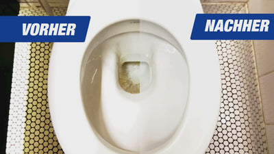 Video Urinstein entfernen