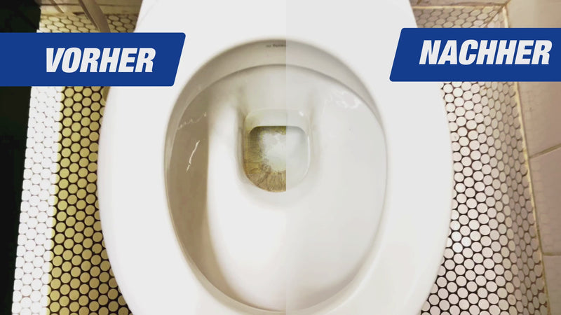 Video Urinstein entfernen